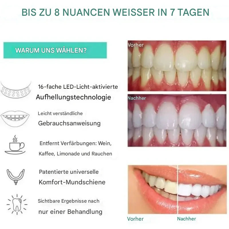 Whitening Lamp - LED Bleaching-Mundschiene